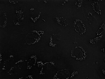 In this salmon fat cell (in principle similar to a human cell), the stores of fat are seen as small droplets inside the cell. In this salmon fat cell (in principle similar to a human cell), the stores of fat are seen as small droplets inside the cell.