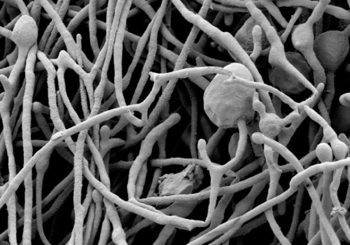 Elektronmikroskopbilde av tre måneder gamle sopptråder av A. finlayi. (Foto: Science/AAAS) Elektronmikroskopbilde av tre måneder gamle sopptråder av A. finlayi. (Foto: Science/AAAS)