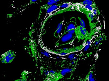 Lymfocyttene, en type hvit blodcelle, til denne fisken er farget blå på dette bilde. Rundt dem ser vi "Saturns ringer": Et protein som motvirker virus i kroppen. (Foto: Jacob Torgersen/Nofima Marin) Lymfocyttene, en type hvit blodcelle, til denne fisken er farget blå på dette bilde. Rundt dem ser vi "Saturns ringer": Et protein som motvirker virus i kroppen. (Foto: Jacob Torgersen/Nofima Marin)