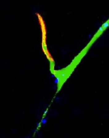Bilde av et motonevron. Den oransje delen er aksonet, der signaler sendes videre til musklene. De blå prikkene er synapsene. (Foto: PNAS) Bilde av et motonevron. Den oransje delen er aksonet, der signaler sendes videre til musklene. De blå prikkene er synapsene. (Foto: PNAS)