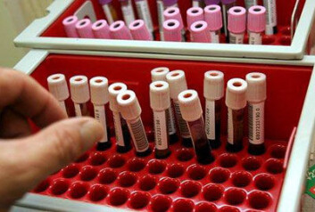 Biologisk materiale, her i form av blodprøver. (Foto: Colourbox.no) Biologisk materiale, her i form av blodprøver. (Foto: Colourbox.no)