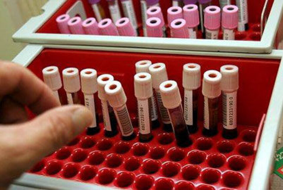 Biologisk materiale, her i form av blodprøver. (Foto: Colourbox.no)
