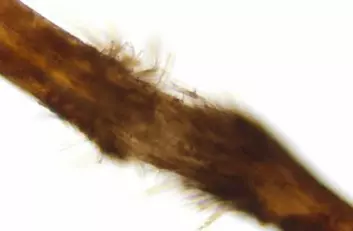 Et bilde tatt under mikroskop av det 90 år gamle håret fra Australia. (Foto: Silvana Tridico/Science/AAAS)