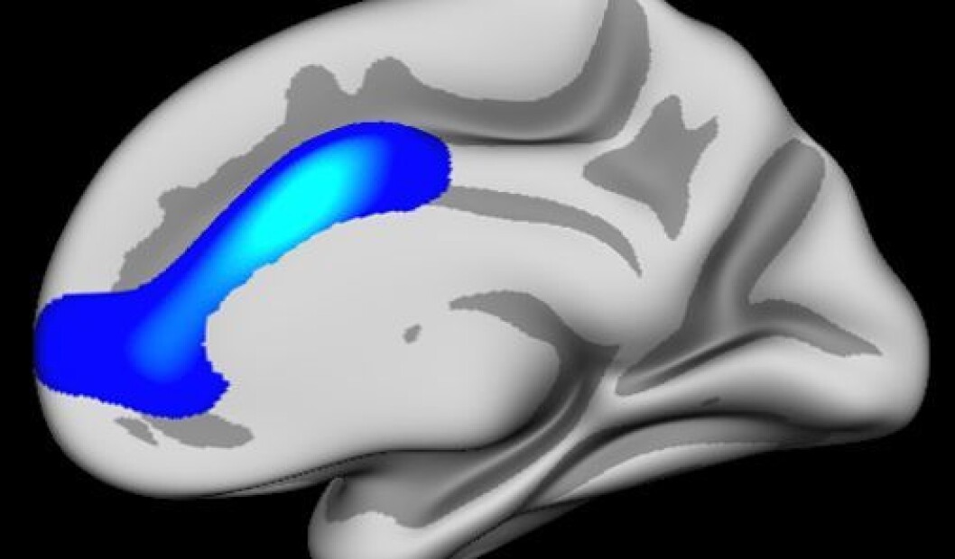Hjerneområdet i blått er sentralt i utviklingen av selvregulering og viser hvor forskerne fant effekter. Området overlapper nesten nøyaktig med Anterior cingulate, men dekker også litt mer. (Foto: (Illustrasjon: Anders M. Fjell/UiO)) Hjerneområdet i blått er sentralt i utviklingen av selvregulering og viser hvor forskerne fant effekter. Området overlapper nesten nøyaktig med Anterior cingulate, men dekker også litt mer. (Foto: (Illustrasjon: Anders M. Fjell/UiO))