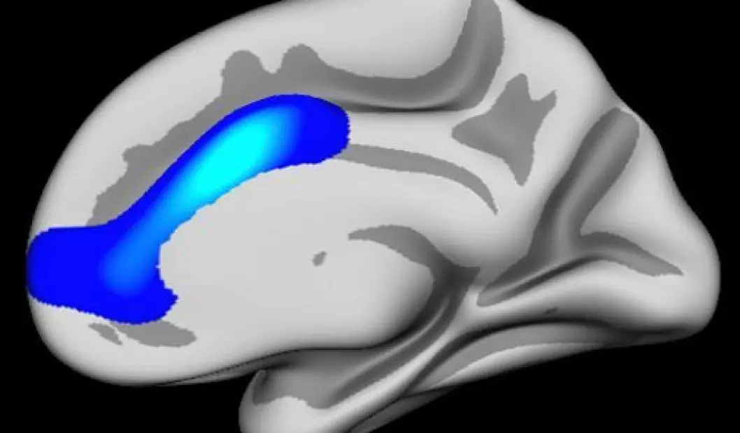 Hjerneområdet i blått er sentralt i utviklingen av selvregulering og viser hvor forskerne fant effekter. Området overlapper nesten nøyaktig med Anterior cingulate, men dekker også litt mer. (Foto: (Illustrasjon: Anders M. Fjell/UiO))