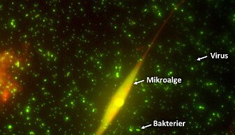 Figur 1: Mikroskopbilde av mikroorganismer, som lyser fordi DNA har blitt farget. Virus (minste lyse brikker), Bakterier (litt større lyse brikker), Kiselalge (største lyse organisme). Figur 1: Mikroskopbilde av mikroorganismer, som lyser fordi DNA har blitt farget. Virus (minste lyse brikker), Bakterier (litt større lyse brikker), Kiselalge (største lyse organisme).