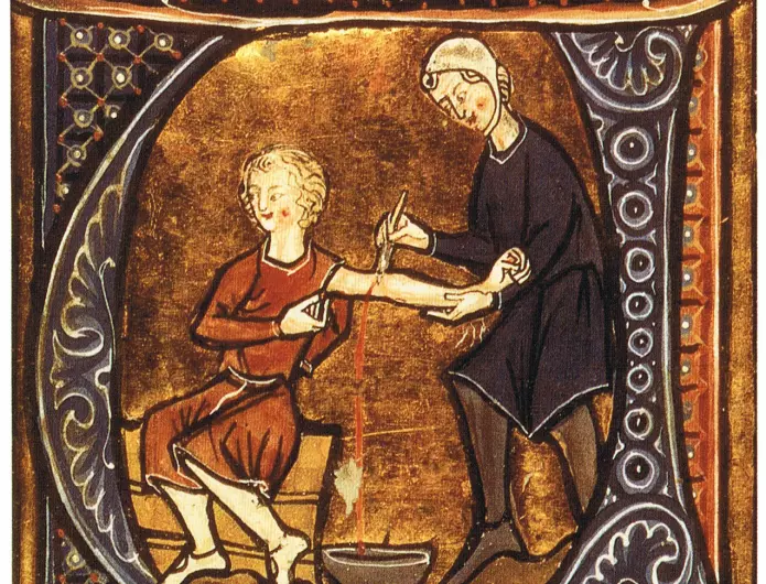 Blodtapping var mye brukt som behandling både i middelalderen og senere.