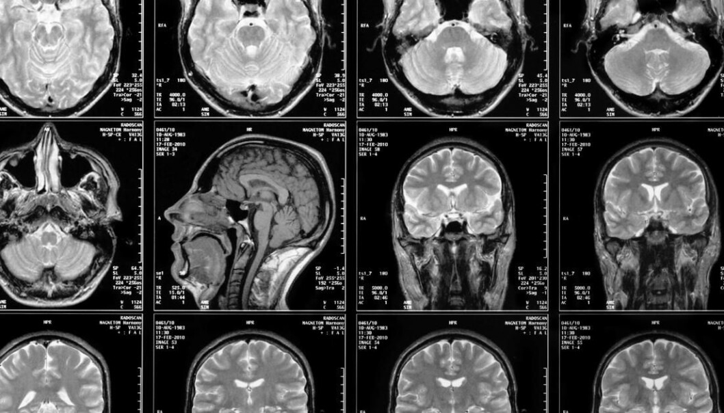 MR-bilder er egentlig satt sammen av en lang rekke mindre biter. Det er helt avgjørende at disse blir riktig rekonstruert. MR-bilder er egentlig satt sammen av en lang rekke mindre biter. Det er helt avgjørende at disse blir riktig rekonstruert.