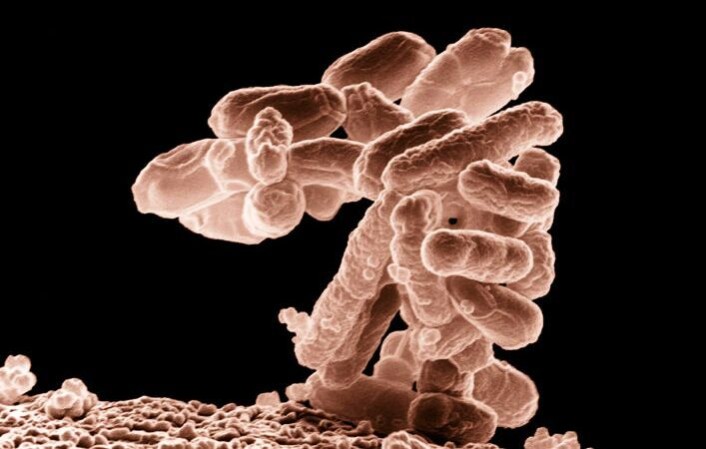 En klase E.coli-bakterier forstørret 10 000 ganger. (Foto: Agricultural Research Service/ Wikimedia Commons) En klase E.coli-bakterier forstørret 10 000 ganger. (Foto: Agricultural Research Service/ Wikimedia Commons)