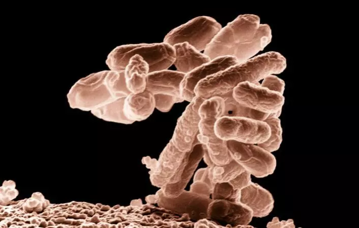 En klase E.coli-bakterier forstørret 10 000 ganger. (Foto: Agricultural Research Service/ Wikimedia Commons)