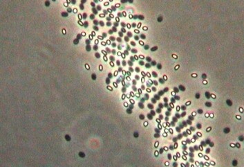Spiring av Bacillus pumilus-sporer observert i et fasekontrastmikroskop. De lysende sporene er i en dvaletilstand hvor de er spesielt motstandsyktige mot varme. Når sporene spirer blir de mørke på fargen, samtidig som de blir mer varmesenitive. (Foto: Irene S. Løvdal) Spiring av Bacillus pumilus-sporer observert i et fasekontrastmikroskop. De lysende sporene er i en dvaletilstand hvor de er spesielt motstandsyktige mot varme. Når sporene spirer blir de mørke på fargen, samtidig som de blir mer varmesenitive. (Foto: Irene S. Løvdal)