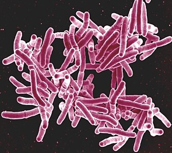 Tuberkulose er forårsaket av bakterien <i>Mycobacterium tuberculosis.</i> Tuberkulose er forårsaket av bakterien <i>Mycobacterium tuberculosis.</i>