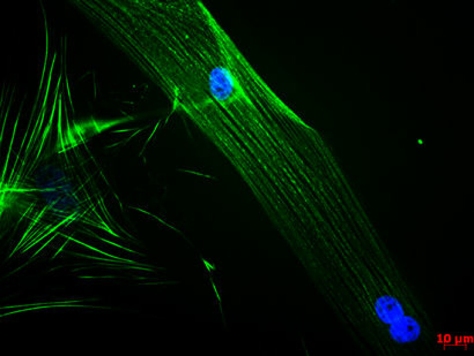 Celler som har begynt å danne muskelfibre. Det blå er cellekjerner, mens det grønne er proteiner som holder cellene sammen. (Foto: Sissel B. Rønning)