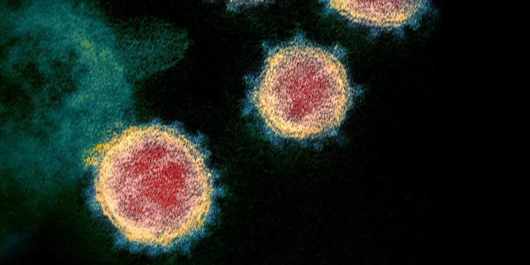 Koronaviruset SARS-CoV-2, som forårsaker covid-19, sett i mikroskop.