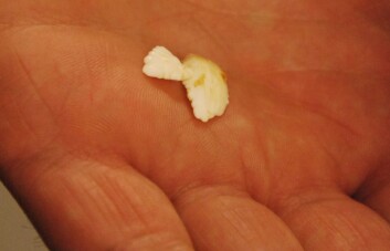 På disse otolittene kan rester etter blod og annet vev sees som noen brune avleiringer. I dem var det DNA å finne. (Foto: Hanne Østli Jakobsen) På disse otolittene kan rester etter blod og annet vev sees som noen brune avleiringer. I dem var det DNA å finne. (Foto: Hanne Østli Jakobsen)