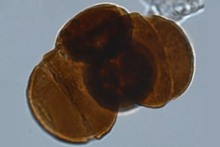 Genetisk mutert pollenkorn frå 200 millionar år gammalt bartre. (Foto: Wofram M. Küschner, Universitetet i Oslo)