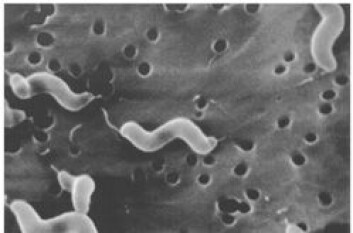"Campylobacter er den mest utbredte sykdomsfremkallende bakterien i den vestlige verden." "Campylobacter er den mest utbredte sykdomsfremkallende bakterien i den vestlige verden."