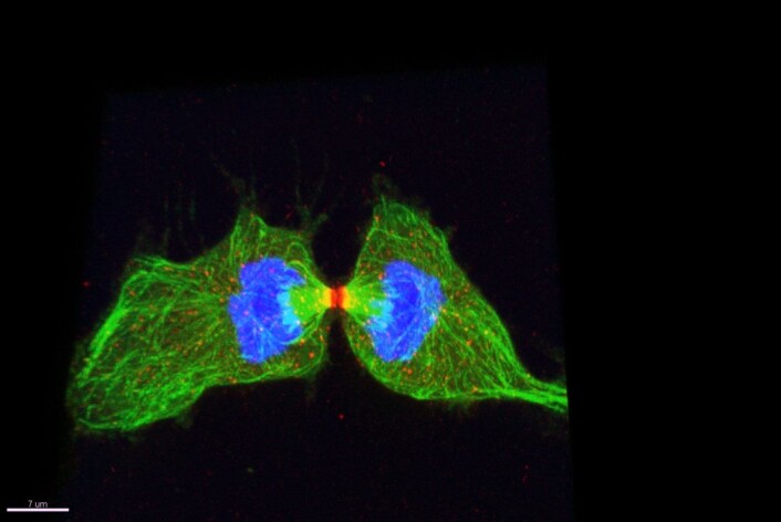Det siste trinnet i celledelingen, der dattercellene fysisk skilles, kalles cytokinese. (Foto: Ellen Skarpen) Det siste trinnet i celledelingen, der dattercellene fysisk skilles, kalles cytokinese. (Foto: Ellen Skarpen)
