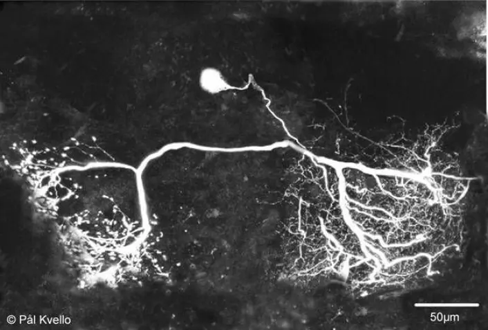 Dette bildet er tatt i mikroskop og viser en nervecelle i insekthjernen som reagerer på sukker. (Foto: Pål Kvello)
