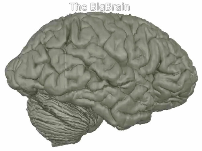 3D-hjernen BigBrain skal legges åpent ut for forskere. (Foto: (Bilde: Fra video av Montreal Neurological Institute/McGill University, Institute of Neuroscience and Medicine/Research Centre Juelich, and National Research Council of Canada.))