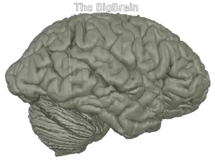 3D-hjernen BigBrain skal legges åpent ut for forskere. (Foto: (Bilde: Fra video av Montreal Neurological Institute/McGill University, Institute of Neuroscience and Medicine/Research Centre Juelich, and National Research Council of Canada.)) 3D-hjernen BigBrain skal legges åpent ut for forskere. (Foto: (Bilde: Fra video av Montreal Neurological Institute/McGill University, Institute of Neuroscience and Medicine/Research Centre Juelich, and National Research Council of Canada.))
