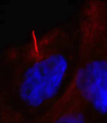 Defekter i cellens cilier (rød strek) er årsak til over 30 forskjellige sykdommer. Dansk grunnforskning skal kartlegge cilienes funksjon, slik at det i framtidens kan lages medisiner til millioner av mennesker som lider av cilierelaterte sykdommer. (Foto: Lotte Bang Pedersen)