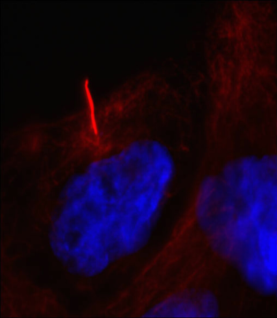 Defekter i cellens cilier (rød strek) er årsak til over 30 forskjellige sykdommer. Dansk grunnforskning skal kartlegge cilienes funksjon, slik at det i framtidens kan lages medisiner til millioner av mennesker som lider av cilierelaterte sykdommer. (Foto: Lotte Bang Pedersen)