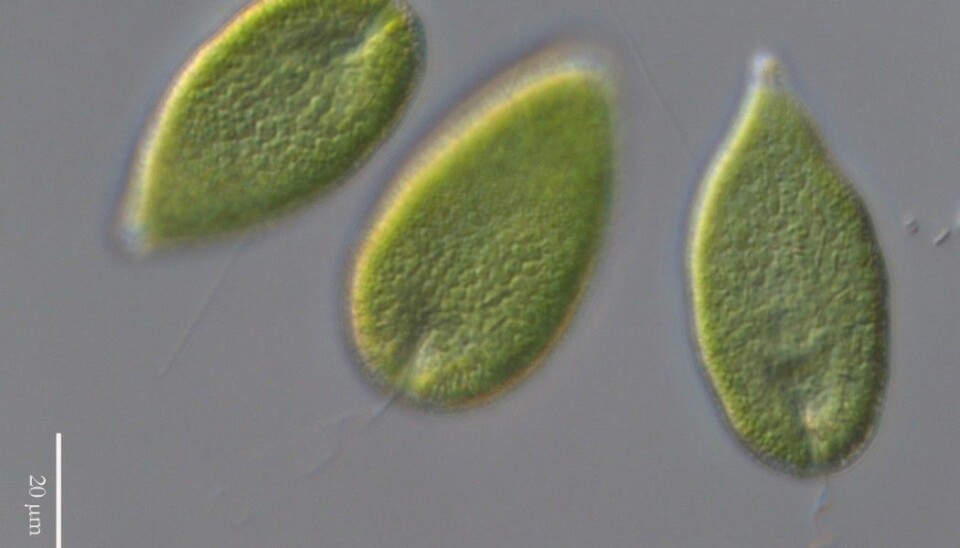 The algae Gonyostomum semen under a microscope.