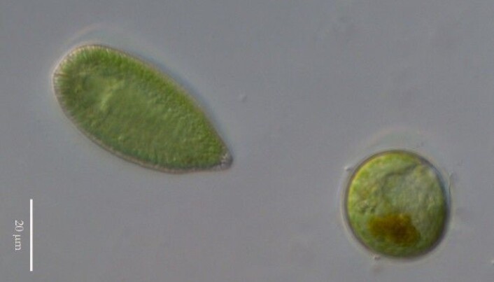 The algae Gonyostomum semen under a microscope. The algae Gonyostomum semen under a microscope.