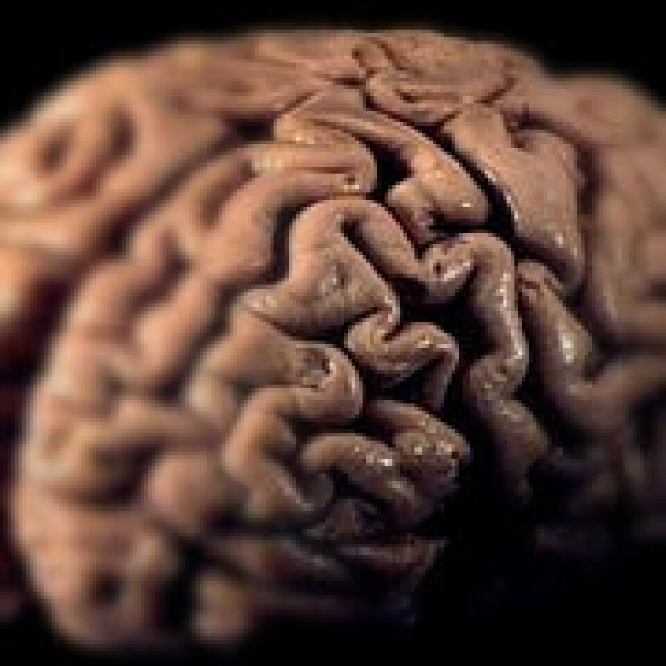 'Hjernen har ordet i sin makt. (Foto: www.colorbox.no)'