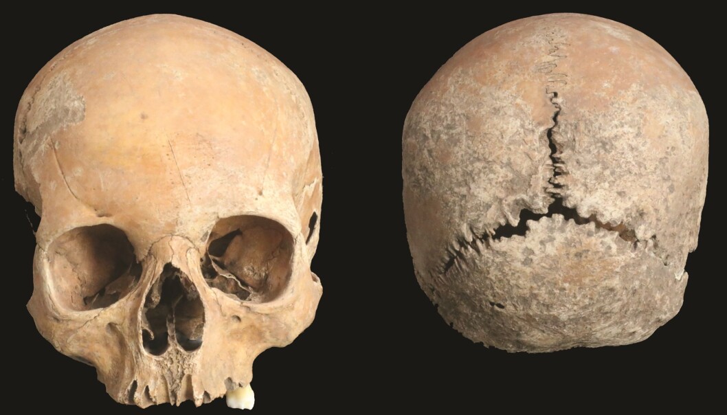 Denne hodeskallen tilhørte en kvinne som levde i England for 1200 år siden. Denne hodeskallen tilhørte en kvinne som levde i England for 1200 år siden.