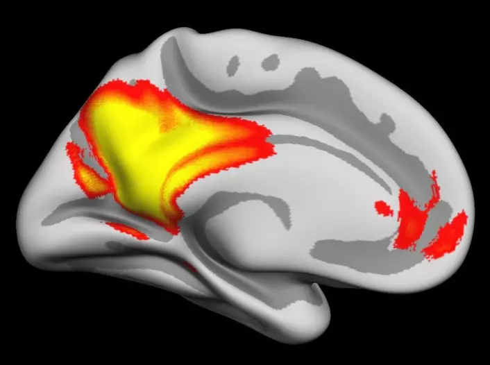 Hjerneaktiviteten i gult og rødt viser områder av hjernebarken involvert i å gjenhente levende minner og fremtidsforestillinger. Områdene snakker ofte sammen og er mest aktive når vi ikke mottar mye ytre stimuli. Aktiviteten er vist på en delvist oppblåst hjerne, som gjør det mulig å se hva som skjer i furene og foldene i hjernebarken. (Foto: (Illustrasjon: Inge Amlien/UiO))