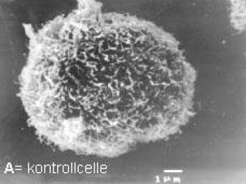 "En kreftcelle. (Foto: Lytix Biopharma)"