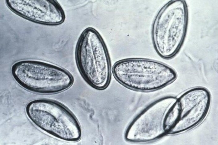 Egga til barnemarken Enterobius vermicularis kan smitte til andre ved dårleg handhygiene. Egga er om lag 0,0006 centimeter lange, og er berre synlege under mikroskop. (Foto: Wikimedia Commons) Egga til barnemarken Enterobius vermicularis kan smitte til andre ved dårleg handhygiene. Egga er om lag 0,0006 centimeter lange, og er berre synlege under mikroskop. (Foto: Wikimedia Commons)