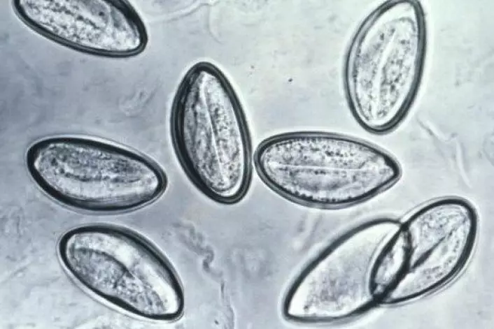 Egga til barnemarken Enterobius vermicularis kan smitte til andre ved dårleg handhygiene. Egga er om lag 0,0006 centimeter lange, og er berre synlege under mikroskop. (Foto: Wikimedia Commons)