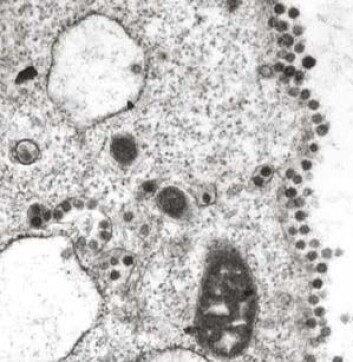 "SARS-viruset slik det ser ut i et mikroskop. (Foto: University of Hong Kong)" "SARS-viruset slik det ser ut i et mikroskop. (Foto: University of Hong Kong)"