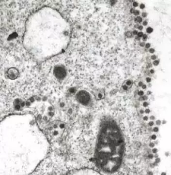 "SARS-viruset slik det ser ut i et mikroskop. (Foto: University of Hong Kong)"
