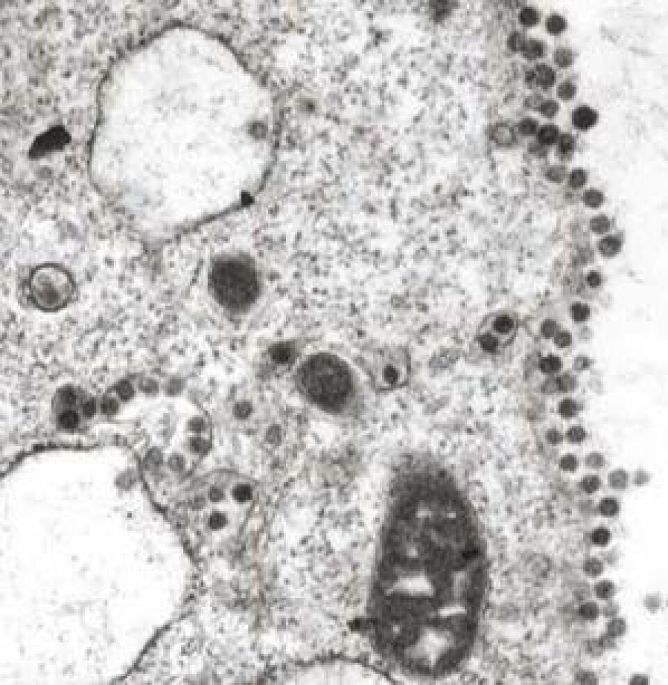 'SARS-viruset slik det ser ut i et mikroskop. (Foto: University of Hong Kong)'