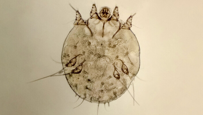 Slik ser skabbmidd (<span class="italic" data-lab-italic_desktop="italic">Sarcoptes scabiei</span>) ut under et mikroskop. Slik ser skabbmidd (<span class="italic" data-lab-italic_desktop="italic">Sarcoptes scabiei</span>) ut under et mikroskop.