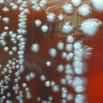 Pestbakterien Yersinia pestis vokser godt, også i laboratoriet. Her på en oveflate av saueblod, der den etter tre døgn har formert seg i speileggaktige former. Motivet er fra 2002. (Foto: Larry Stauffer, Oregon State Public Health Laboratory/CDC) Pestbakterien Yersinia pestis vokser godt, også i laboratoriet. Her på en oveflate av saueblod, der den etter tre døgn har formert seg i speileggaktige former. Motivet er fra 2002. (Foto: Larry Stauffer, Oregon State Public Health Laboratory/CDC)