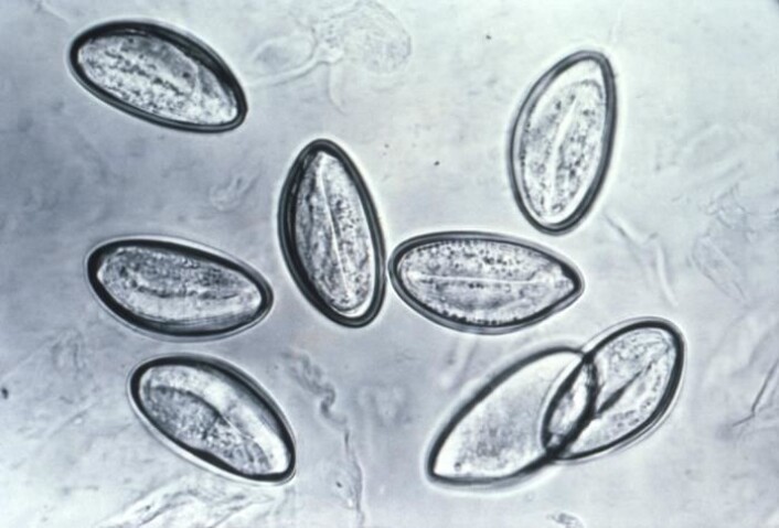 Egg av barnemark (Enterobius vermicularis) i mikroskopet. (Foto: CDC/Wikimedia Commons) Egg av barnemark (Enterobius vermicularis) i mikroskopet. (Foto: CDC/Wikimedia Commons)