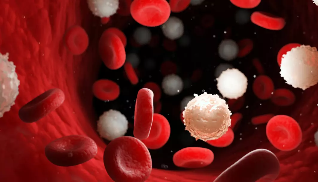 Forsker ved Universitetet i Bergen har fått anerkjennelse for en ny metode å måle effekten av medisin mot blodkreft på. Bildet er en medisinsk nøyaktig illustrasjon av for mange hvite blodceller som skyldes leukemi.