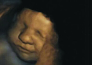Stillbilde fra forskernes 4D-ultralyd av 32 uker gammelt foster, som viser typiske ansiktstrekk for latter. I dette frossede øyeblikket fornemmes et lite lurt smil. (Foto: Nadja Reissland, m. fl, 2011) Stillbilde fra forskernes 4D-ultralyd av 32 uker gammelt foster, som viser typiske ansiktstrekk for latter. I dette frossede øyeblikket fornemmes et lite lurt smil. (Foto: Nadja Reissland, m. fl, 2011)