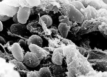 Pestbakterien Yersinia pestis (Foto: Rocky Mountain Laboratories)