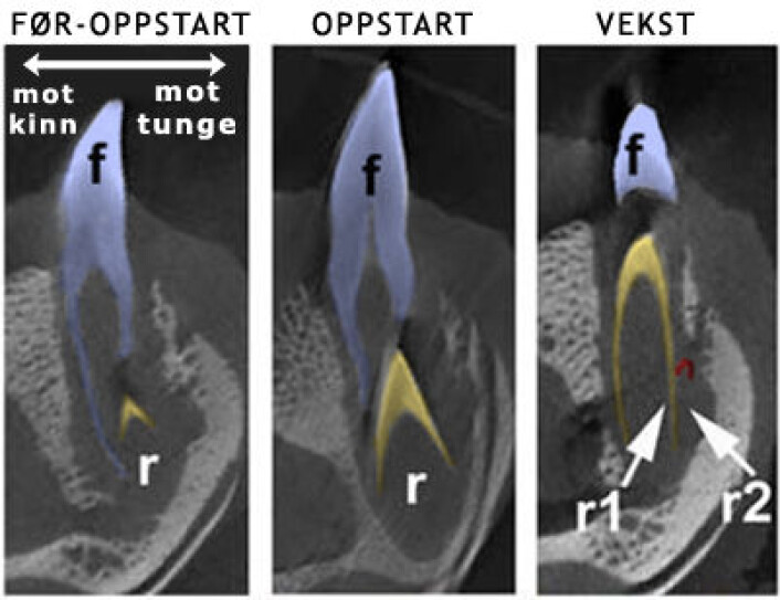 Computertomografi av de tre stadiene i utviklingen av alligatortenner. Blå tann (f): Fullt utviklet, funksjonell tann. Gul tann (r/r1): Ny erstatningstann. Rød tann (r2): Den yngste tanna. (Foto: (Bilde: Ping Wu et.al, fargelagt og oversatt av forskning.no)) Computertomografi av de tre stadiene i utviklingen av alligatortenner. Blå tann (f): Fullt utviklet, funksjonell tann. Gul tann (r/r1): Ny erstatningstann. Rød tann (r2): Den yngste tanna. (Foto: (Bilde: Ping Wu et.al, fargelagt og oversatt av forskning.no))