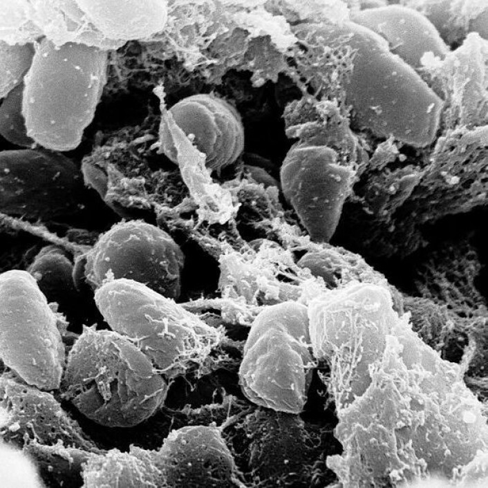 Pestbakterien Yersinia pestis. (Foto: Wikimedia Creative Commons) Pestbakterien Yersinia pestis. (Foto: Wikimedia Creative Commons)
