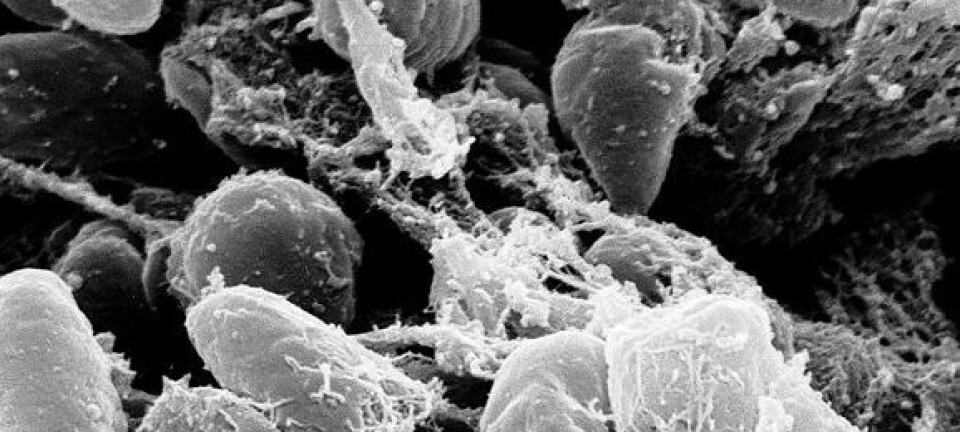 Pestbakterien Yersinia pestis. Wikimedia Creative Commons