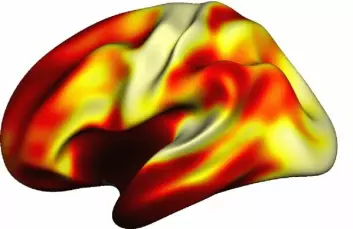 Hjernekartet til venstre viser fordeling av myelin i hjernebarken. Områder som er involvert i syn og hørsel, er relativt sett sterkt myeliniserte, representert ved lyse farger. Områder som antas å være viktige for mer sammensatte og avanserte oppgaver, har en lavere grad av myelin (mørkere farger). Kartet er basert på hjerneavbildning av 85 personer i alderen 27–52 år. (Foto: (Illustrasjon: Håkon Grydeland, UiO))