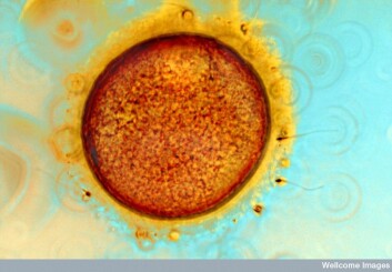 Bilde av menneskelige egg- og sædceller fra prosess med kunstig befruktning (IVF). Bilde av menneskelige egg- og sædceller fra prosess med kunstig befruktning (IVF).