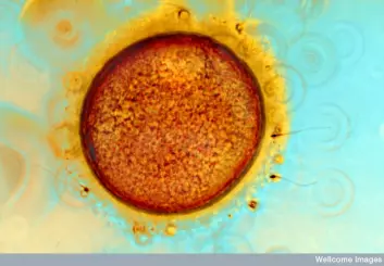 Bilde av menneskelige egg- og sædceller fra prosess med kunstig befruktning (IVF).
